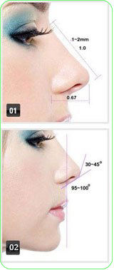 ưu điểm nâng mũi s line 3d